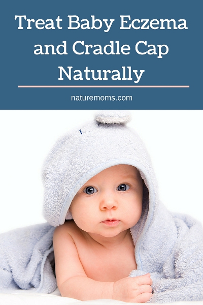 Treat Baby Eczema and Cradle Cap Naturally pin