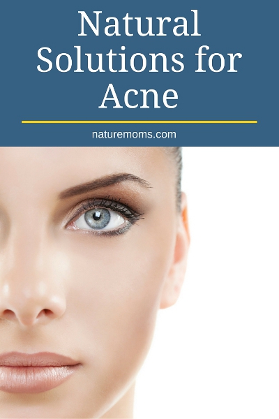 Natural Solutions for Acne