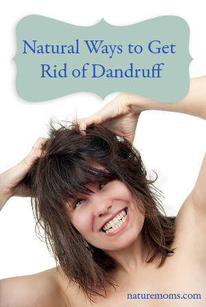 Putting the Breaks on Flakes – Natural Ways to Get Rid of Dandruff