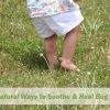 12 Natural Ways to Soothe & Heal Bug Bites