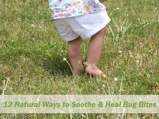 12 Natural Ways to Soothe & Heal Bug Bites