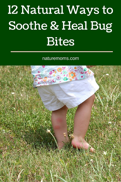 12 Natural Ways to Soothe & Heal Bug Bites