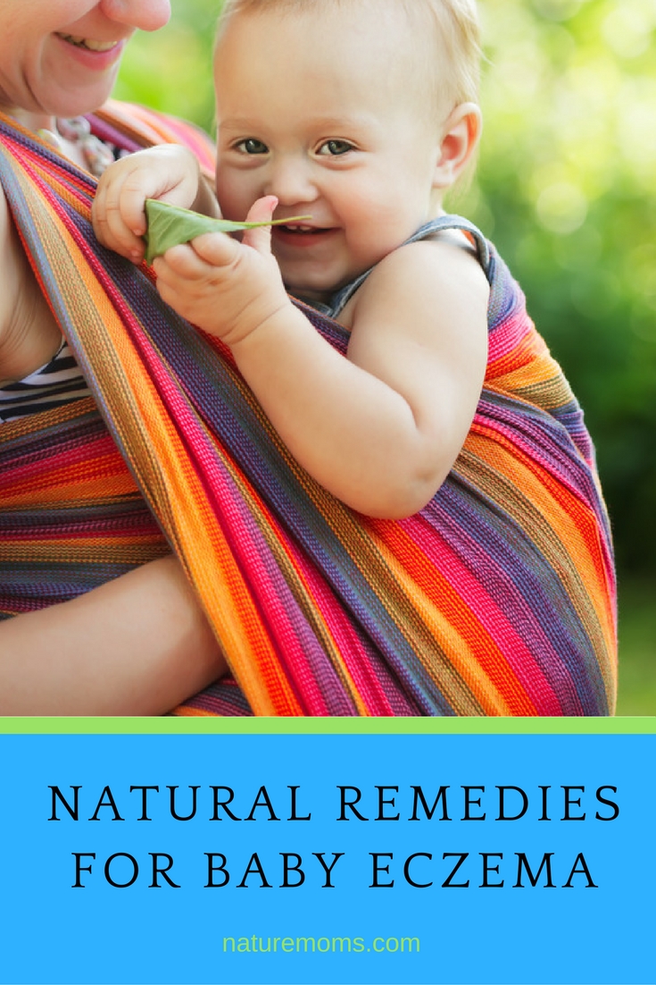 Natural Remedies for Baby Eczema