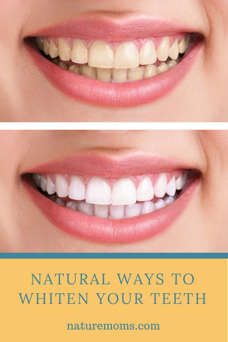 Natural Ways to Whiten Your Teeth